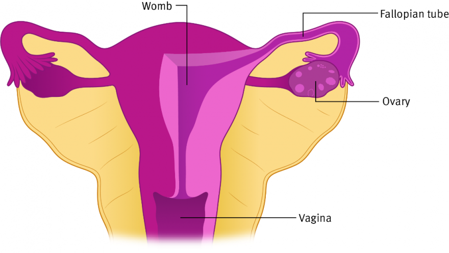 Epithelial Ovarian Cancer Target Ovarian Cancer 